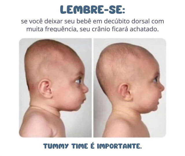 https://www.clinicapneumoped.com.br/wp-content/uploads/2023/06/tummy-time-e-importante.jpg