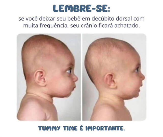 Lembre-se: tummy time é importante - Clínica Pneumoped