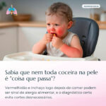 Atencao coceira pele criancas bebes 150x150