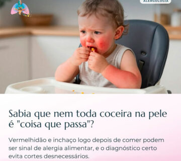 Atencao coceira pele criancas bebes 360x320